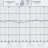 MicroPrecision 5.8 (Frequency response)
